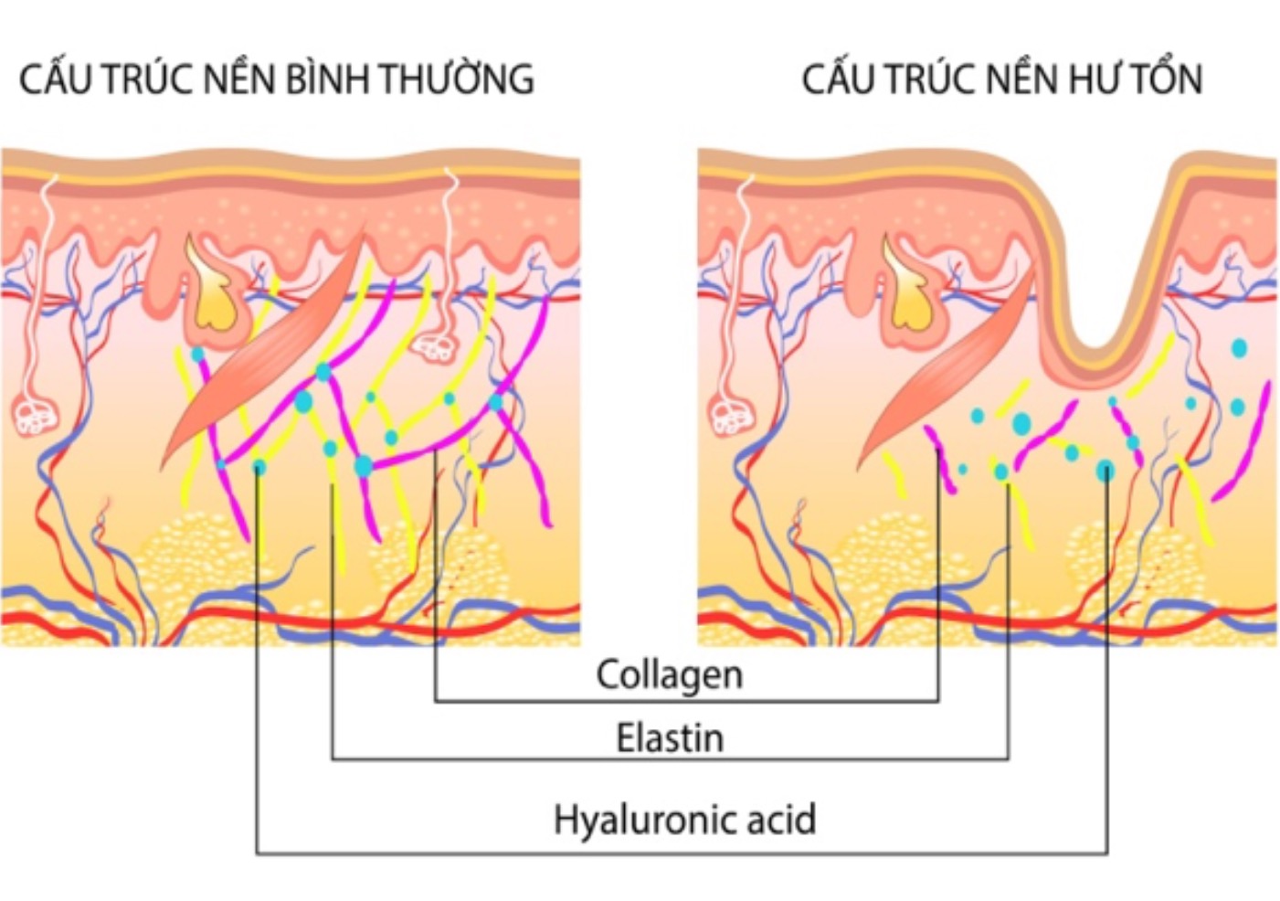 Công dụng của Axit Hyaluronic có trọng Stem Cell Moistuzier và Stem Cell Gold Serum 1